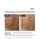 Eucerin Anti-Pigment, serum o podwójnym działaniu, 30 ml